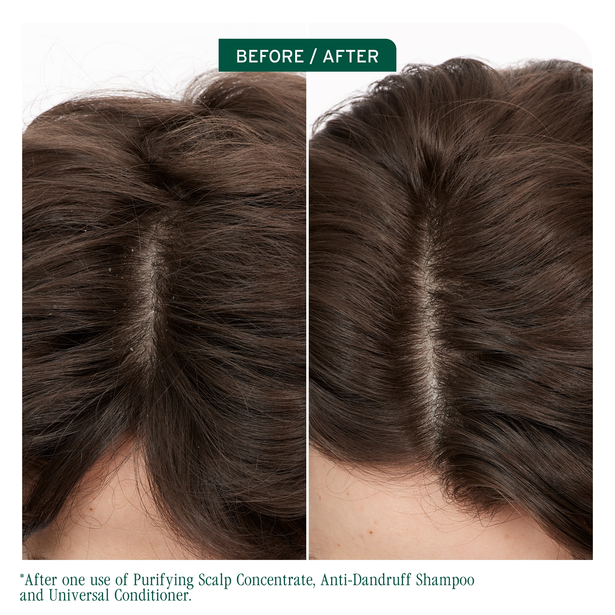 BIOLAGE Scalp Sync Anti-Dandruff Shampoo for Dandruff-Prone Scalp
