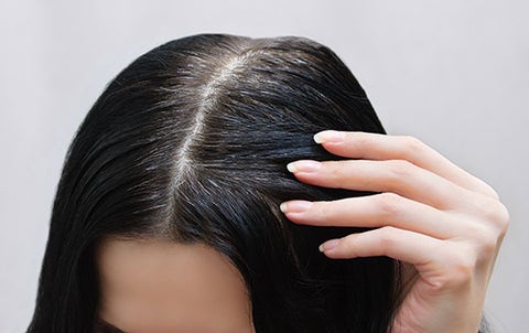 Hair and Scalp Treatment